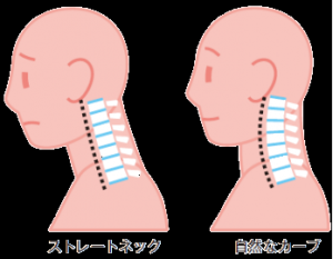ストレートネック
